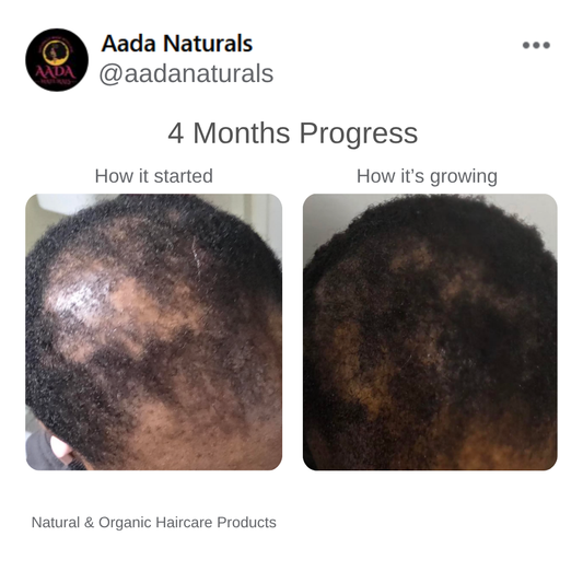 Hair Growth Bundle