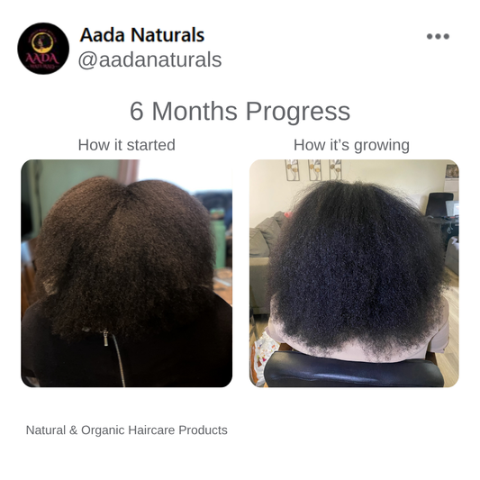 Hair Growth Bundle