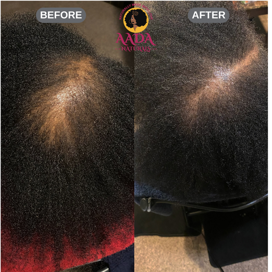 Hair Growth Stimulator Oil